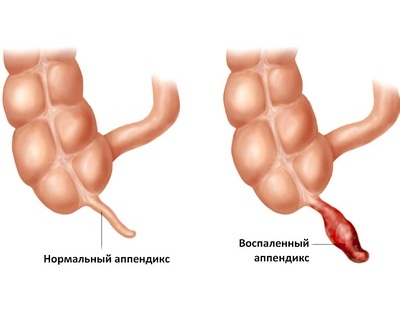 Что делать, если у ребёнка болит живот?6