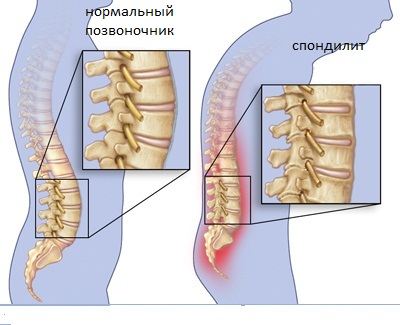 Почему болит спина после сна?6