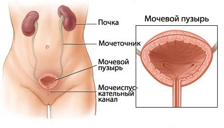 Хронический гонорейный уретрит6