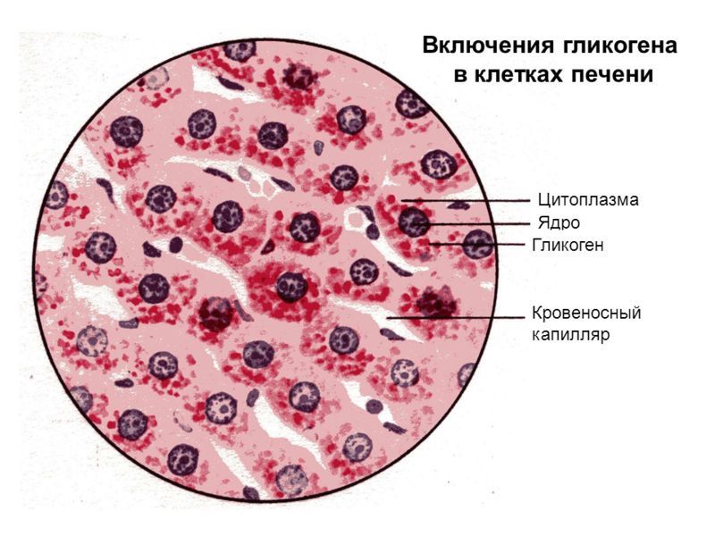 Гипогликемия у детей: причины, симптомы, лечение6