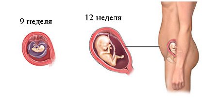 Зубы во время беременности: лечение и анестезия6