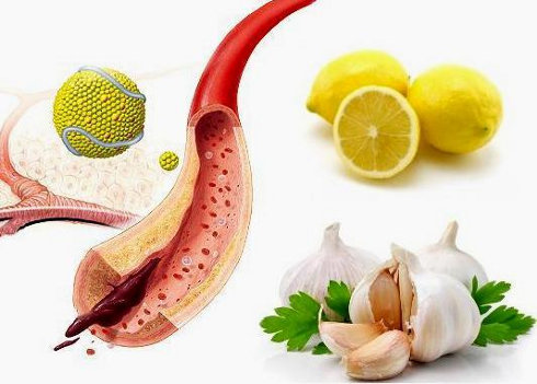 Таблетки от давления: как понизить давление в домашних условиях6