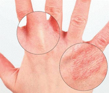 Что делать, если болит палец?6