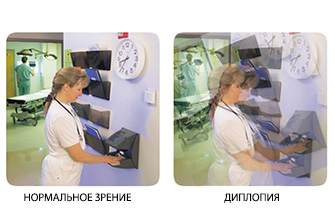 Ухудшение зрения: симптомы, причины, лечение, что делать. Категория болезни глаз. 6