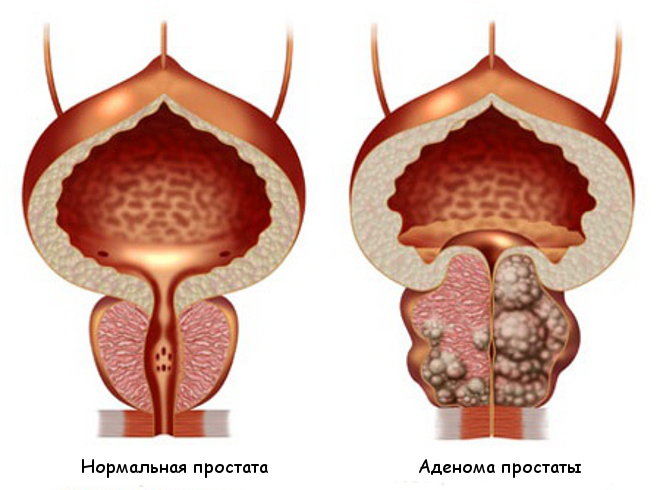 Что делать, если болит низ живота?7