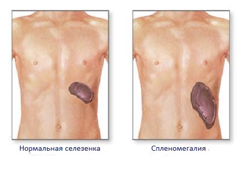 Малярия: диагностика, лечение, профилактика7