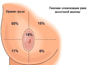 Почему болит грудь после месячных?7