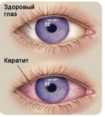 Диагностика и профилактика врожденного сифилиса 7