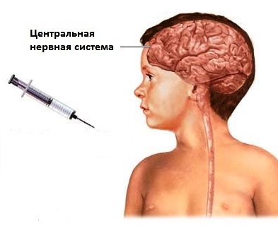 Инфекционные заболевания нервной системы у детей 7