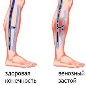Почему при сексе болит бок: причины, лечение, последствия7