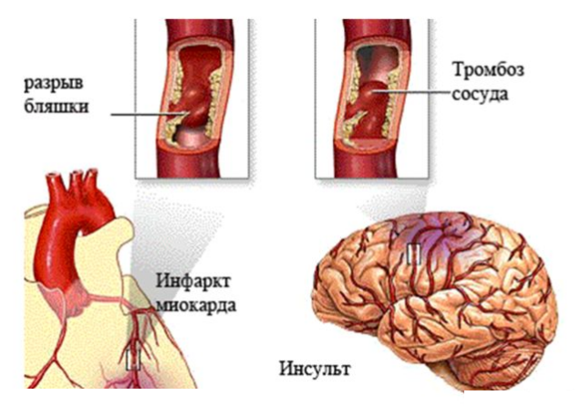 Болит под рёбрами, что делать?7
