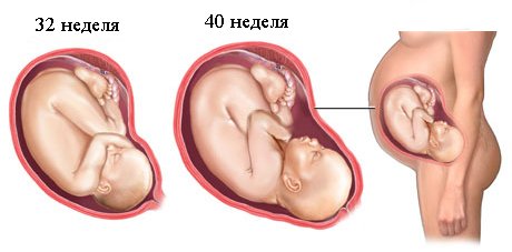 Зубы во время беременности: лечение и анестезия7