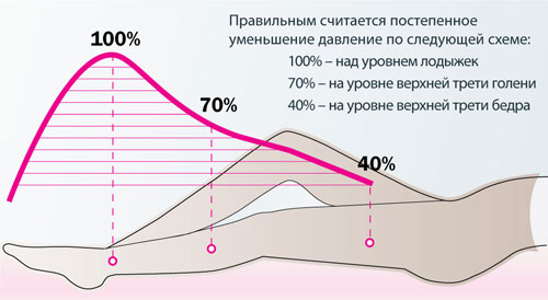 Компрессионное белье при варикозе: какое лучше, отзывы.7