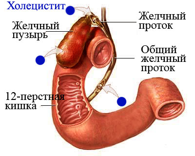 Болит низ живота у женщины, что делать?8
