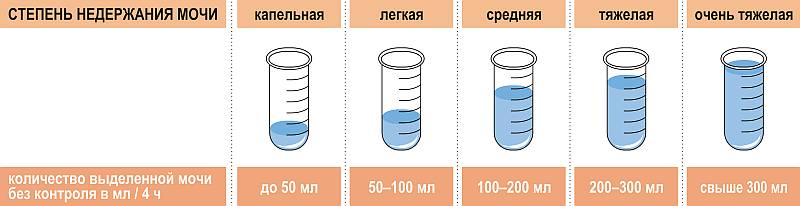 Двусторонний нефролитиаз у детей8