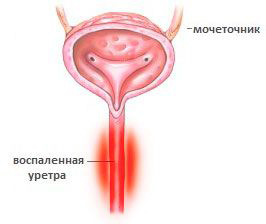 Почему болит правый бок: заболевания, диагностика, методы лечения8