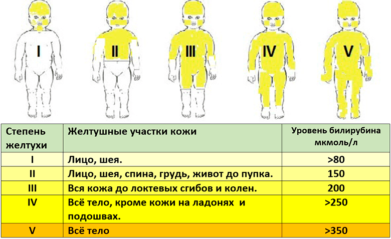Гемолитическая болезнь новорожденных: симптомы, лечение8