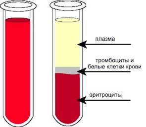 Гипогликемия у детей: причины, симптомы, лечение9