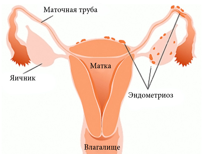 Болезненная овуляция: причины, симптомы, лечение9