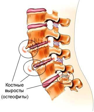 Грязелечение: показания и противопоказания, отзывы9