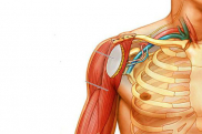 Плечевой плексит
