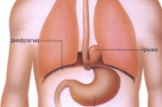 Грыжа пищеводного отверстия диафрагмы